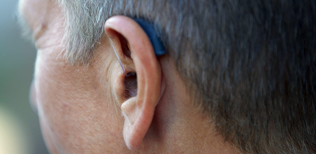 考慮すべき追加オプション